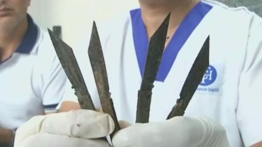 India Police Officer Had ‘Uncontrollable Urge’ To Eat 40 Knives