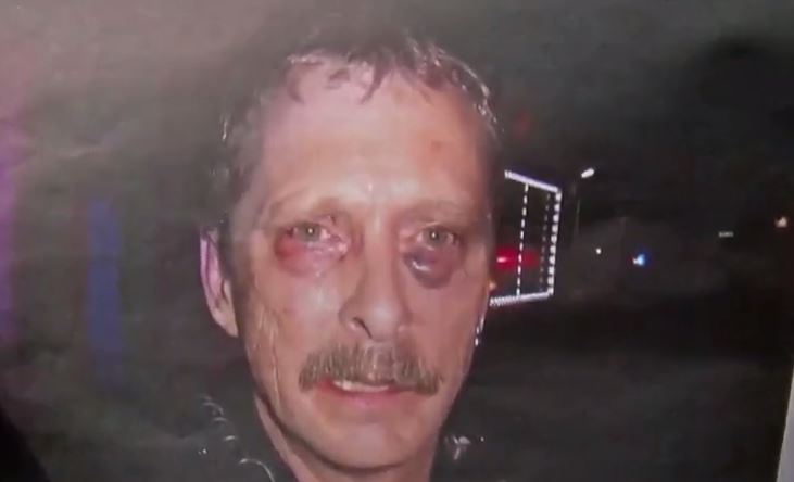 Florida Police Officer Speaks Out After Attack